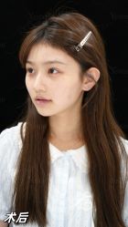 -Yestar重庆艺星医疗美容医院