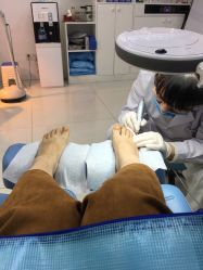 -派恩宜灰指甲鸡眼嵌甲手足癣