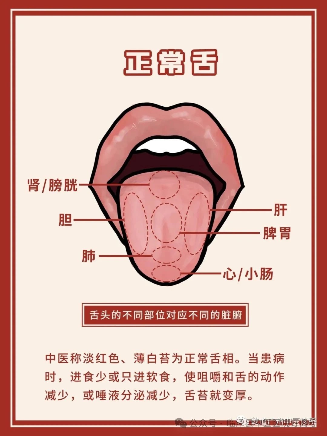 人体正常的舌象图片