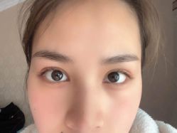 -素美医疗美容·西南眼鼻整形·修复基地