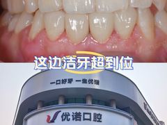 -优诺口腔(华东总院)