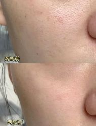 -春田皮肤管理中心品牌旗舰店