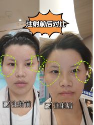 -素美医疗美容·西南眼鼻整形·修复基地