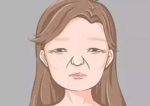 鱼尾纹这么难搞?科医人up帮你"一扫变平"