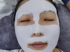 -佐康专业祛痘(淄博旗舰店)