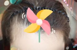 -大麦微针植发全国连锁