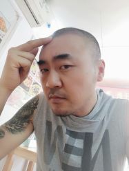 -大麦微针植发丨全国连锁