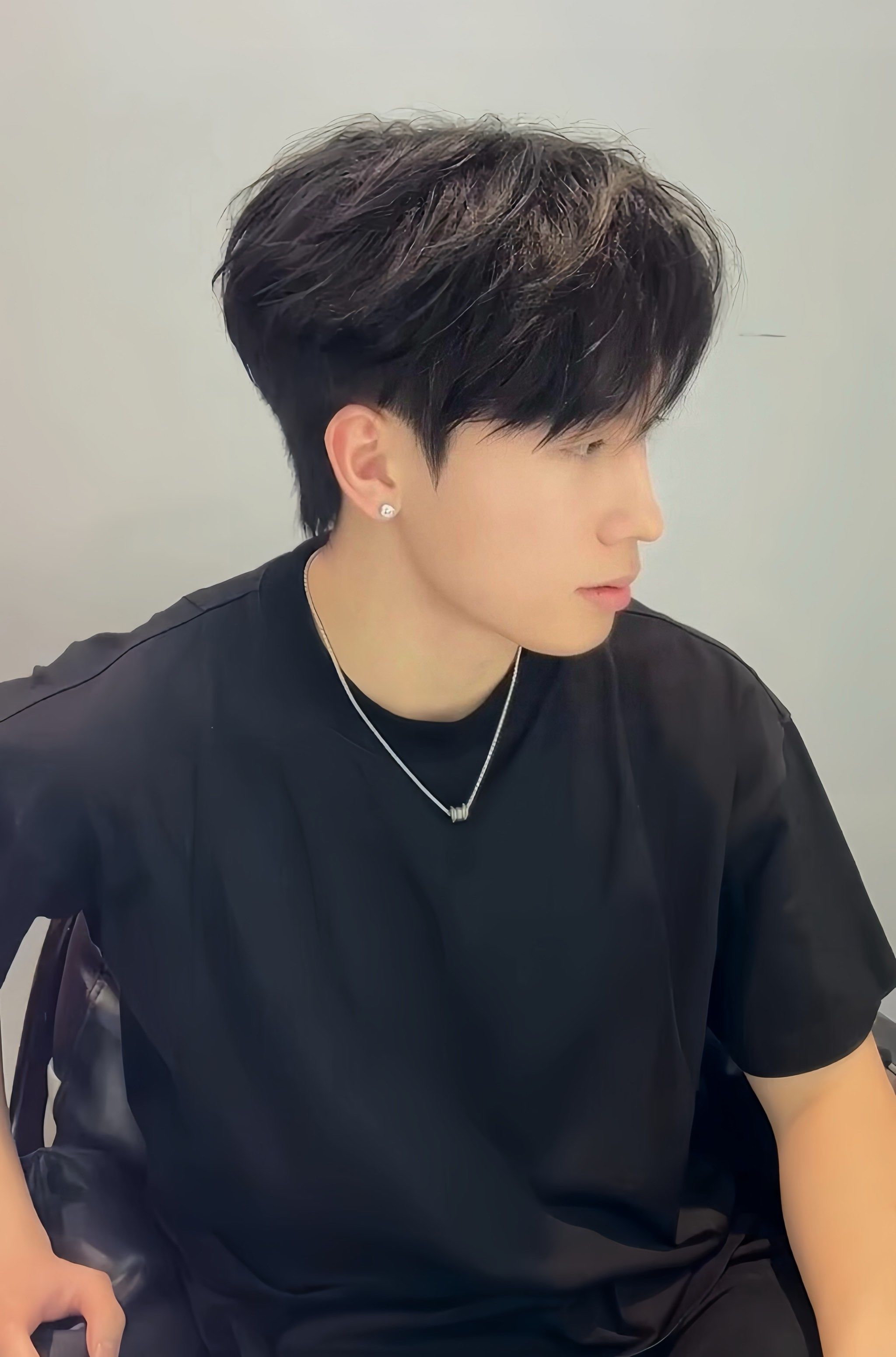 男生的医美 微分碎盖