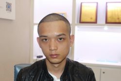 点击看大图 -大麦微针植发丨全国连锁