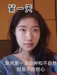 -上海时光整形外科医院