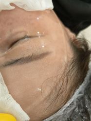 -长沙雅美医疗美容医院