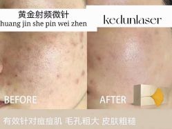 -中科妍美专业脱毛美肤连锁机构