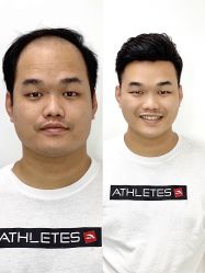 -发饰美男士增发补发假发定制店