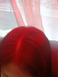 -碧莲盛·不剃发植发