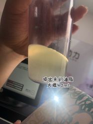 体验后-北京楚诺医疗美容