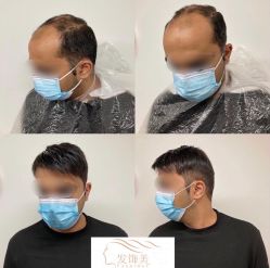 -发饰美男士增发补发假发定制店