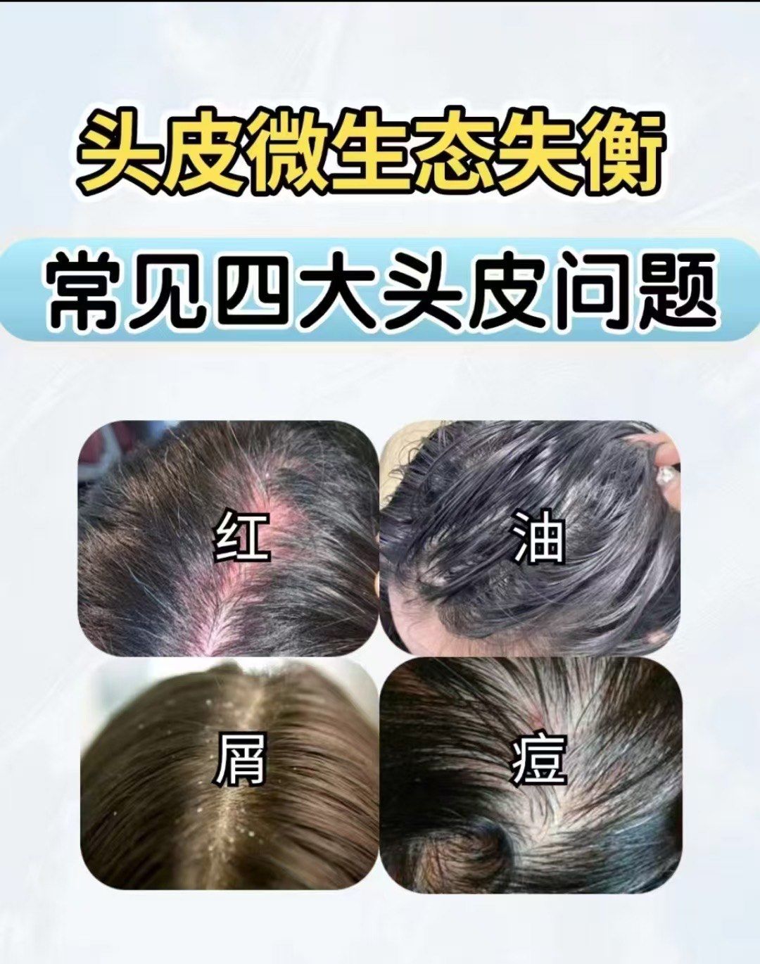 常见的头皮问题