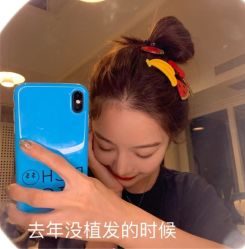 -碧莲盛·不剃发植发