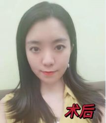-天津健丽·去眼袋医疗美容机构