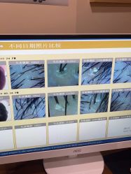 -丝客富脱发养发头皮馆