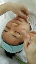 android_upload_pic-传世玉颜专业祛痘·问题肌