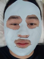 体验后-悟空祛痘·诺奖技术专业店