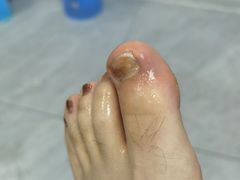 -世龙世家手足健康护理连锁(福田梅林路润裕花园店)