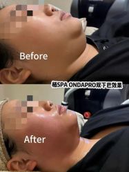 点击看大图 -栖SPA·ONDA ·海菲秀·皑皑科技美肤中心