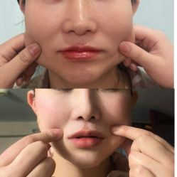 -黎蓓露·徒手骨雕蛋白抗衰·调肤管理