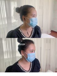 点击看大图 -西施无菌半永久纹绣眉眼影唇轻增发纹发际线