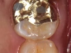 -精德口腔·种植修复·儿牙中心(财富中心店)