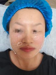 -深圳米兰柏羽医疗美容医院