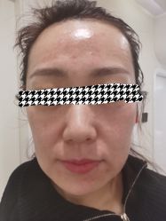 -海涛医疗美容·面部抗衰·注射美鼻