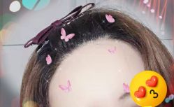 -大麦微针植发全国连锁