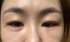 体验后-Yestar重庆艺星医疗美容医院