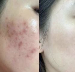 -LUNA皮相美·骨相美高级美感