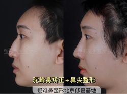 -北京米扬丽格医疗美容·联合丽格鼻整形中心