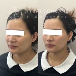 -MLP美丽派·问题肌疗愈中心