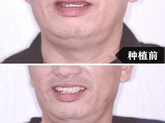 -团圆口腔·种植中心(锦江院区)