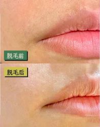 -天津伊美尔医疗整形美容专科医院
