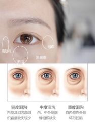 -大华韩艺整形美容医院