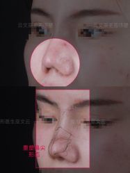 -北京米扬丽格医疗美容·联合丽格鼻整形中心