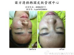 点击看大图 -苗方清颜痘肌研究所