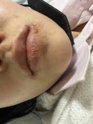 -More摩尔医美の注射线雕光电中心