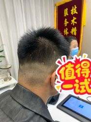 体验前-大麦微针植发全国连锁