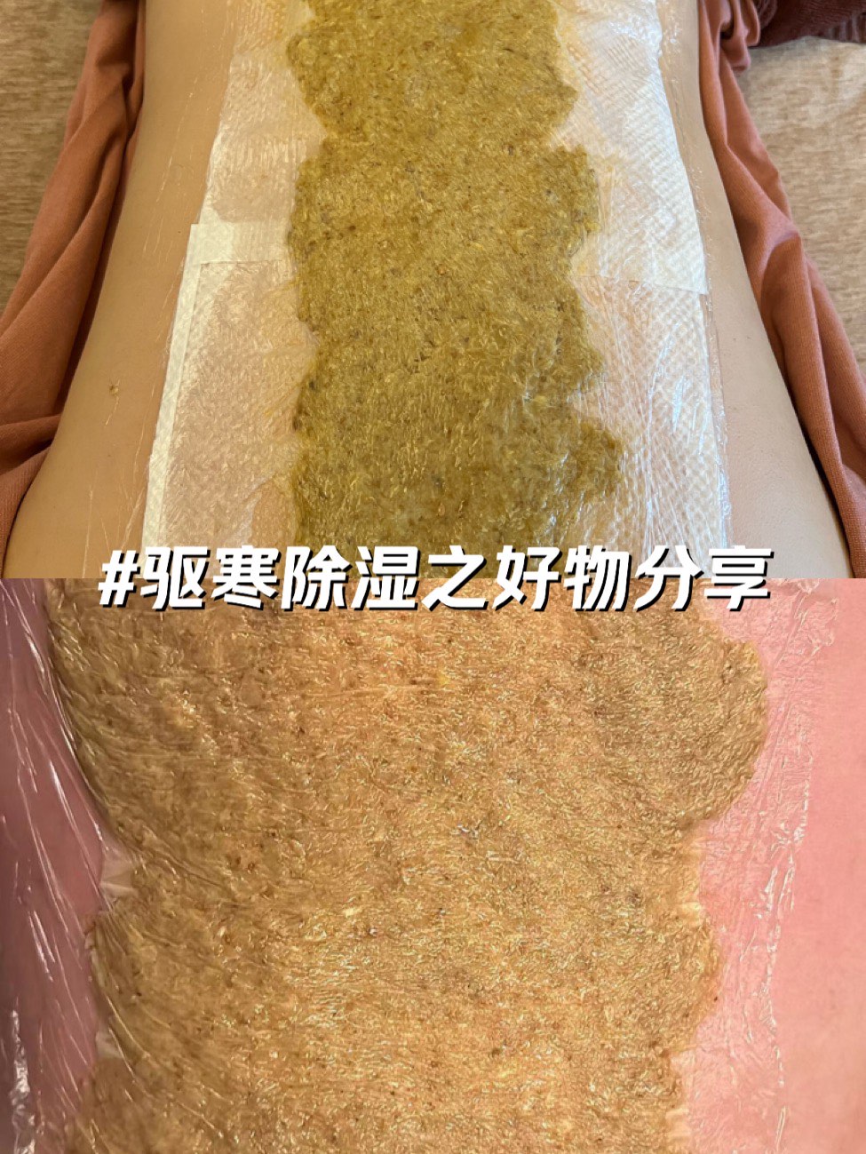 暖宫拔罐哪个位置图片图片