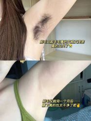 -小梨·OndaPro·专业脱毛连锁机构