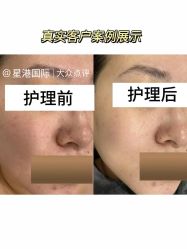 -星港国际·Skin皮肤专研·皮肤管理