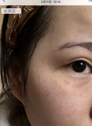 体验后-郑荃丽格医疗美容