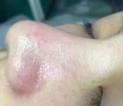 -荟草堂专业痘肌皮肤管理